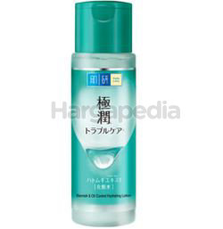Hada Labo Blemish & Oil Control Hydrating Lotion 170ml Hada Labo Blemish & Oil Control Hydrating Lotion 170ml